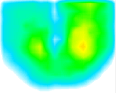 リハビリ介入前