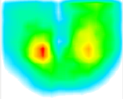 リハビリ介入後